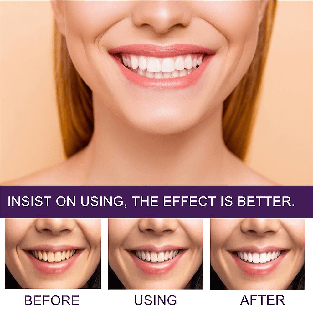 Purple Whitening Toothpaste Yellow Teeth Stains Removal - 50ml